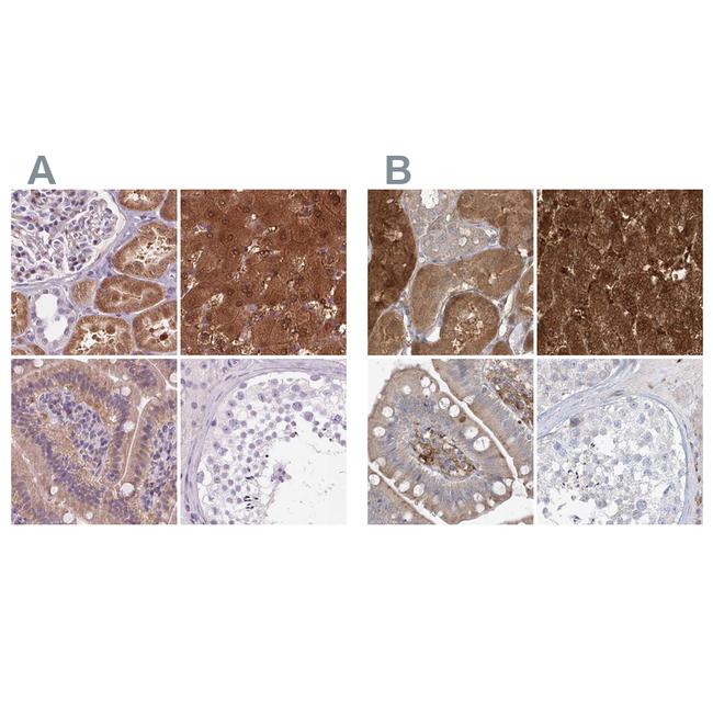 HAAO Antibody in Immunohistochemistry (IHC)