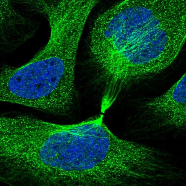 IQCB1 Antibody in Immunocytochemistry (ICC/IF)