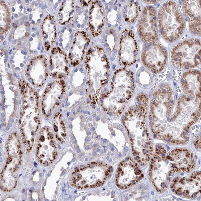 NUDT7 Antibody in Immunohistochemistry (Paraffin) (IHC (P))