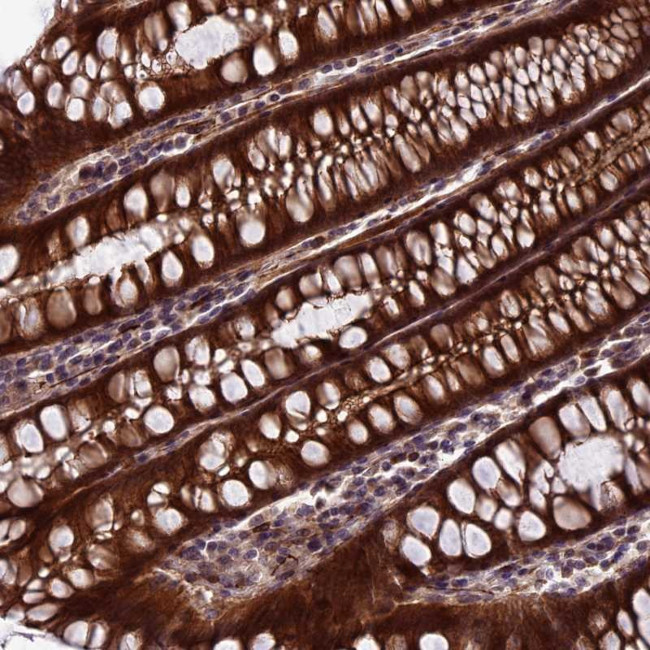 SIPA1L3 Antibody in Immunohistochemistry (Paraffin) (IHC (P))