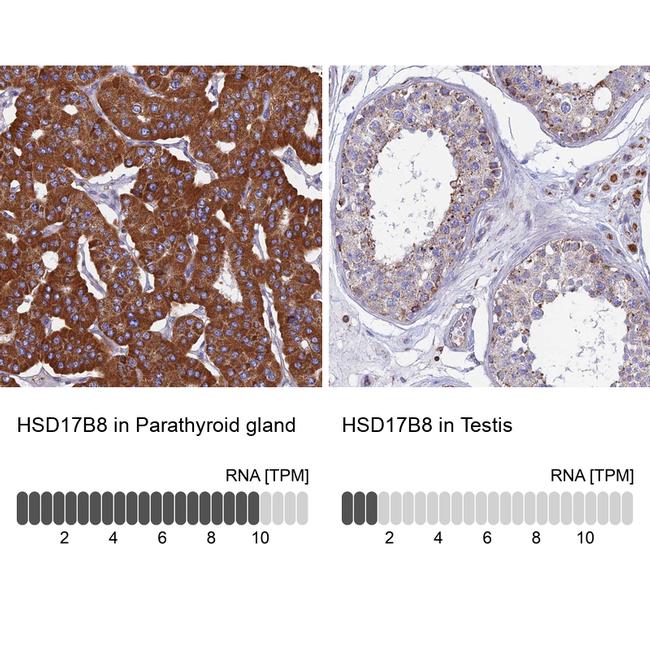 HSD17B8 Antibody in Immunohistochemistry (IHC)