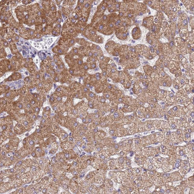 SLC25A2 Antibody in Immunohistochemistry (Paraffin) (IHC (P))