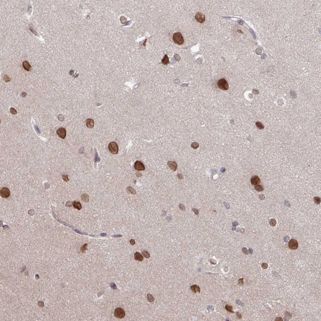 RBM4 Antibody in Immunohistochemistry (Paraffin) (IHC (P))