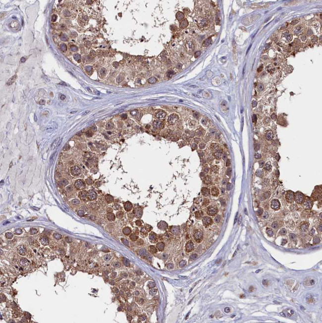 CIAPIN1 Antibody in Immunohistochemistry (Paraffin) (IHC (P))