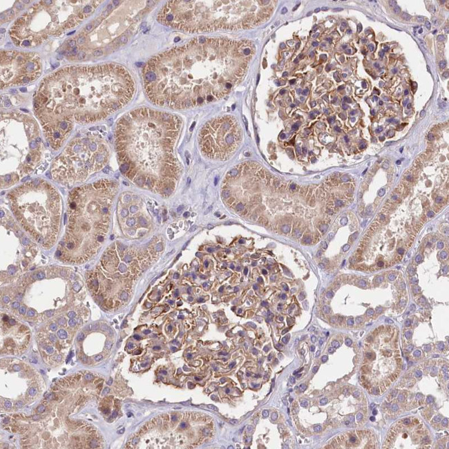 F1A alpha Antibody in Immunohistochemistry (Paraffin) (IHC (P))