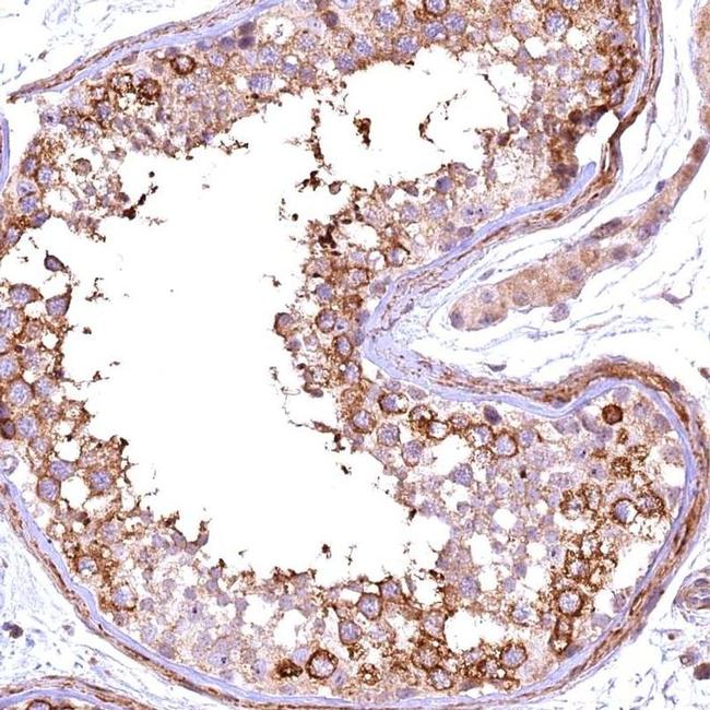 FUZ Antibody in Immunohistochemistry (IHC)