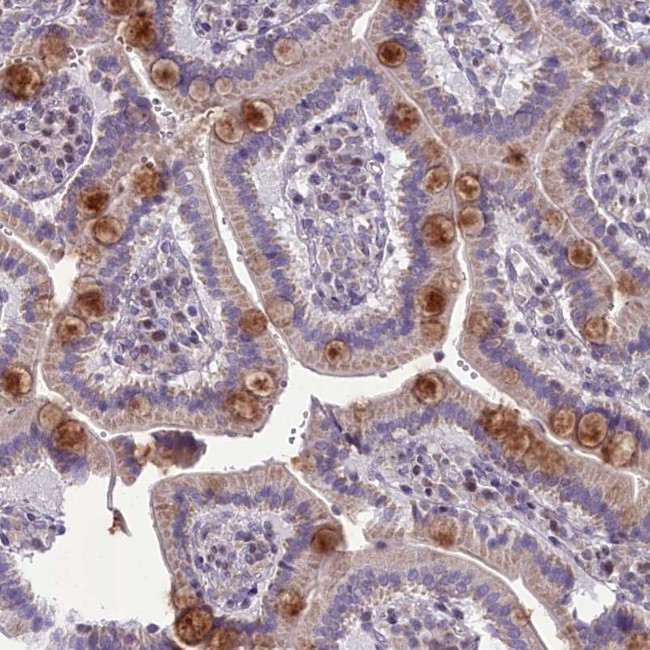 B9D2 Antibody in Immunohistochemistry (Paraffin) (IHC (P))