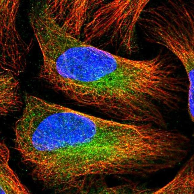 PAM Antibody in Immunocytochemistry (ICC/IF)