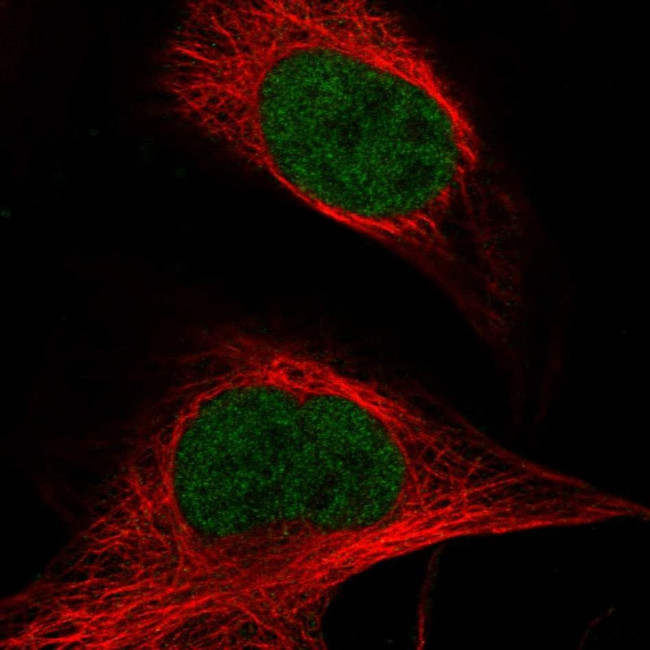 ASH2L Antibody in Immunocytochemistry (ICC/IF)