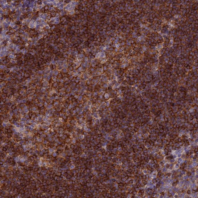 EDAR Antibody in Immunohistochemistry (Paraffin) (IHC (P))