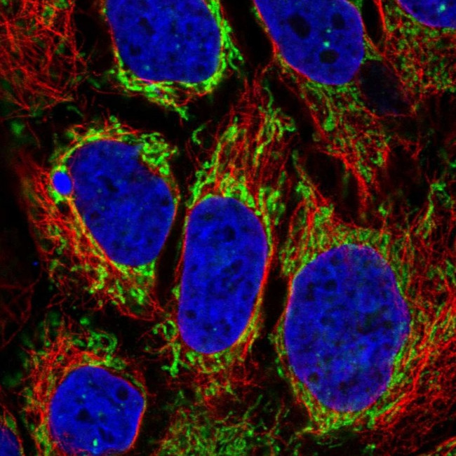 ACAA2 Antibody in Immunocytochemistry (ICC/IF)