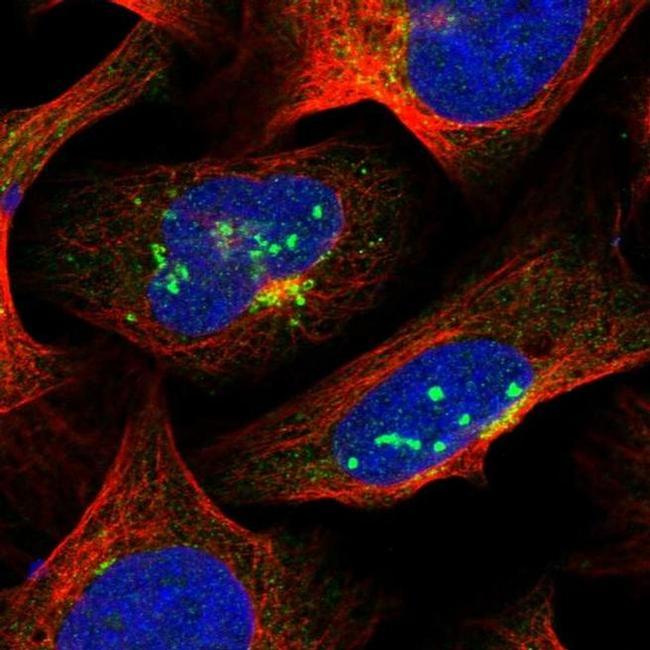 SUR1 Antibody in Immunocytochemistry (ICC/IF)