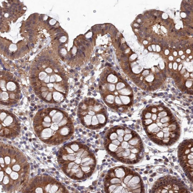 ELOVL6 Antibody in Immunohistochemistry (Paraffin) (IHC (P))