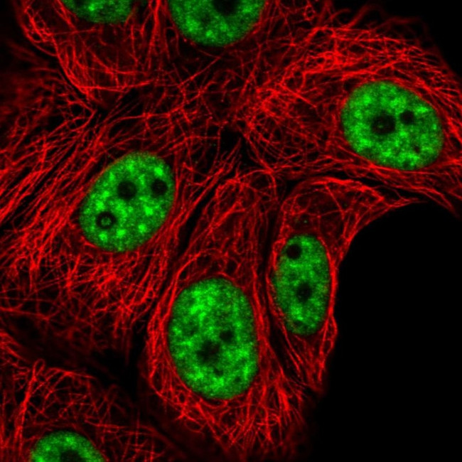 AKAP8L Antibody in Immunocytochemistry (ICC/IF)