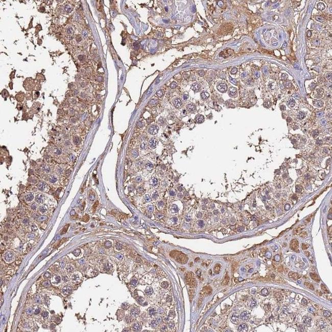 GluD1 Antibody in Immunohistochemistry (IHC)