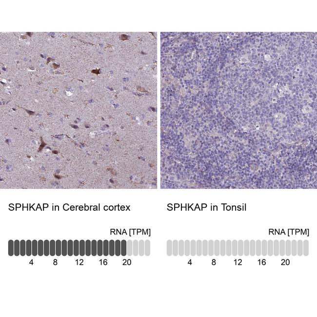 SPHKAP Antibody in Immunohistochemistry (IHC)