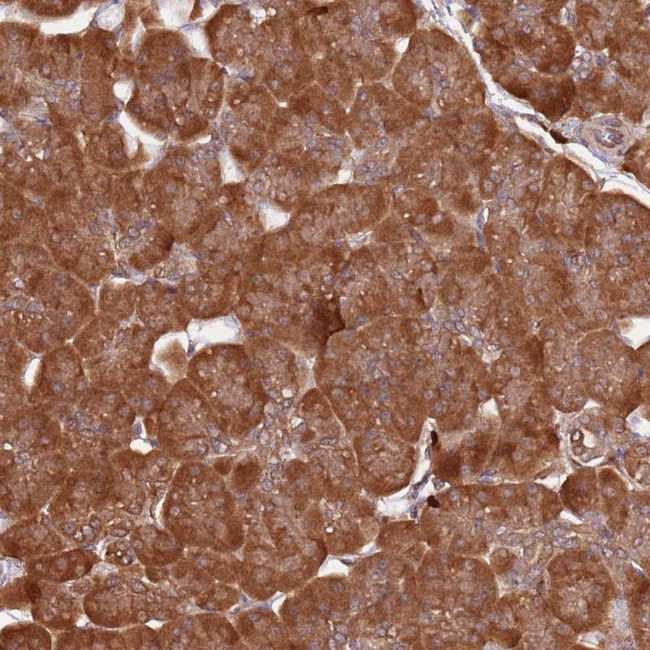 COG4 Antibody in Immunohistochemistry (Paraffin) (IHC (P))