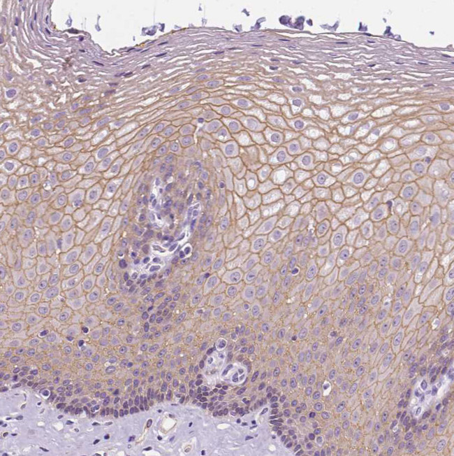 Periplakin Antibody in Immunohistochemistry (Paraffin) (IHC (P))