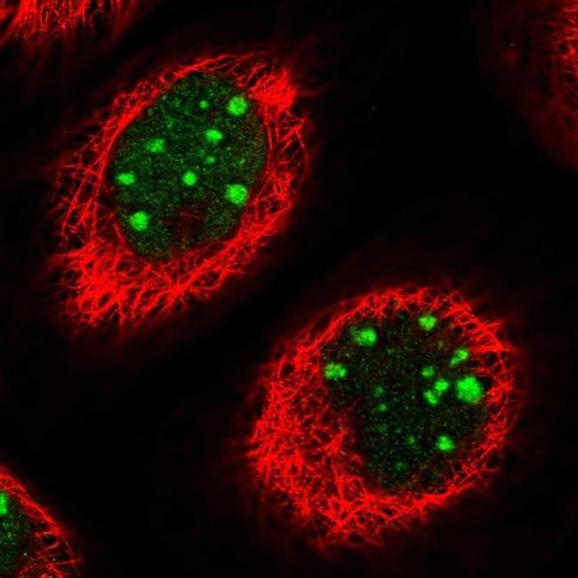 TBL3 Antibody in Immunocytochemistry (ICC/IF)