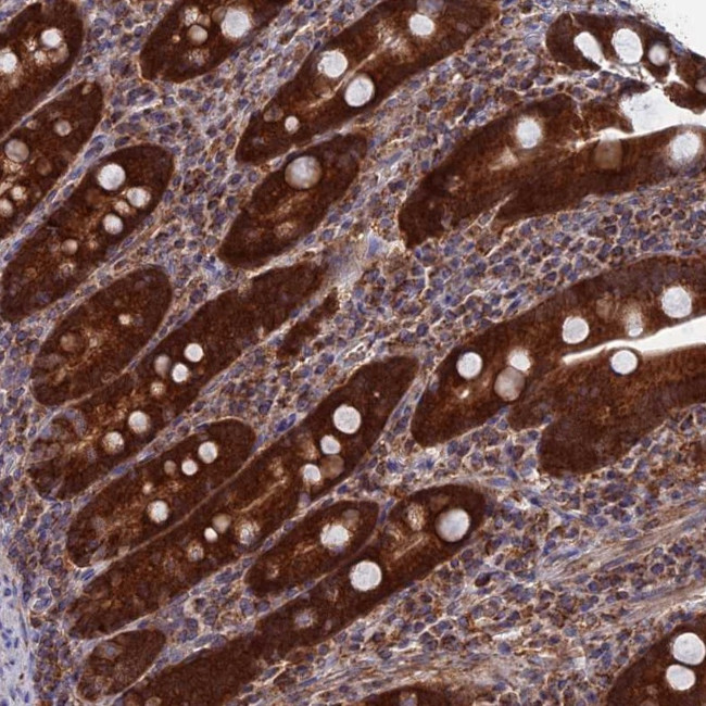 DTYMK Antibody in Immunohistochemistry (Paraffin) (IHC (P))