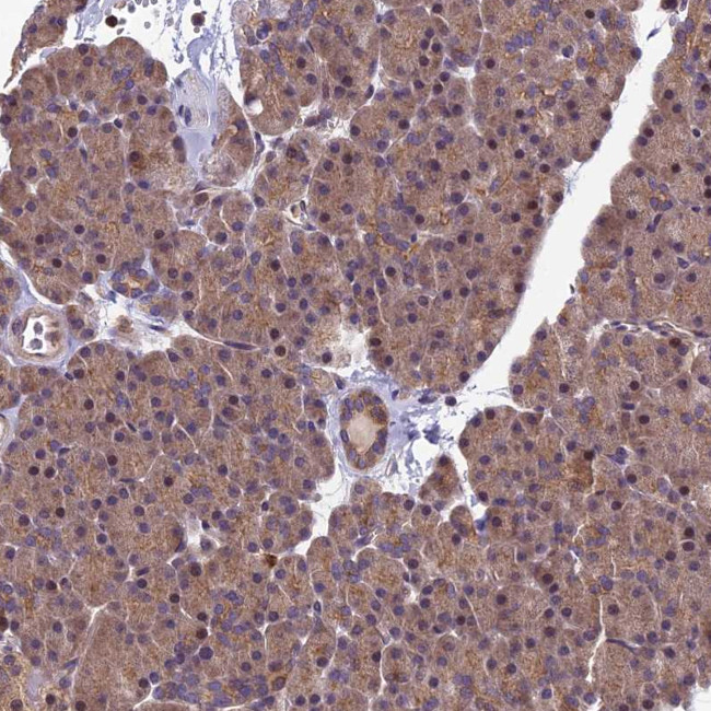 PIKFYVE Antibody in Immunohistochemistry (Paraffin) (IHC (P))