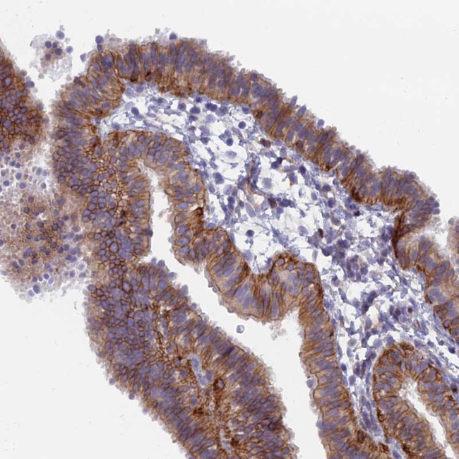 B9D2 Antibody in Immunohistochemistry (Paraffin) (IHC (P))