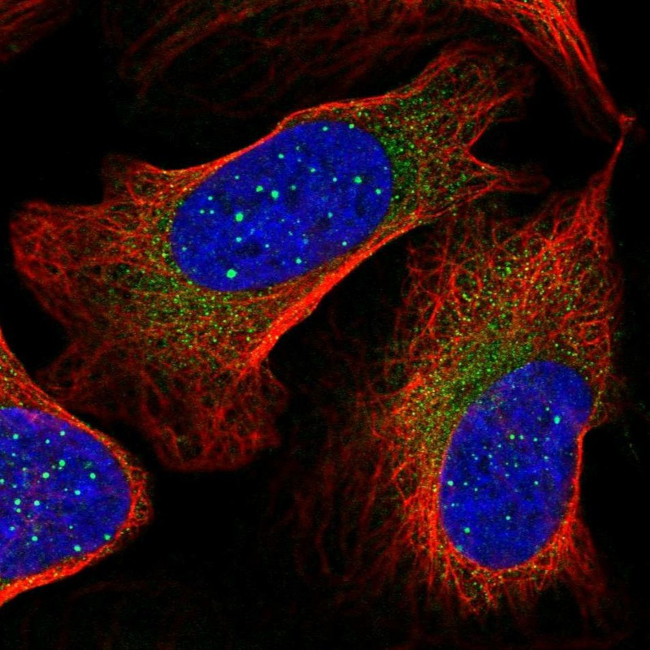 RARS2 Antibody in Immunocytochemistry (ICC/IF)