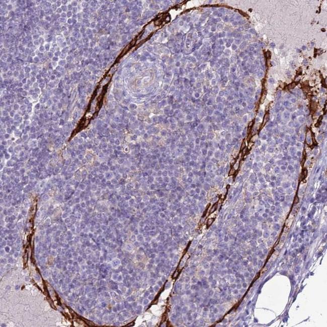 CD299 (DC-SIGN/L) Antibody in Immunohistochemistry (IHC)