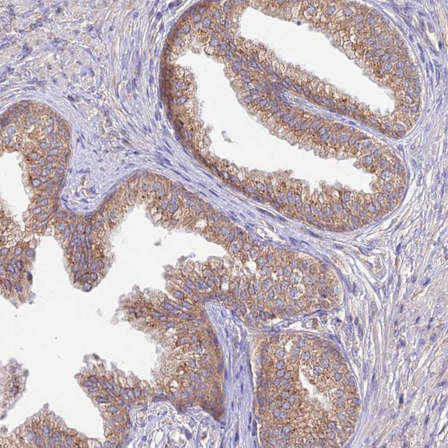 TMEM259 Antibody in Immunohistochemistry (Paraffin) (IHC (P))