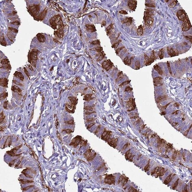 RABL2A Antibody in Immunohistochemistry (IHC)