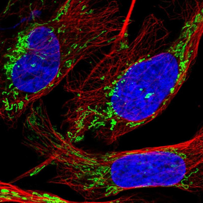 DTYMK Antibody in Immunocytochemistry (ICC/IF)