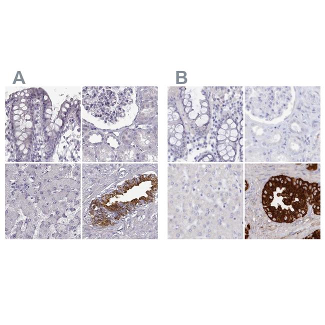 SEMG2 Antibody in Immunohistochemistry (IHC)