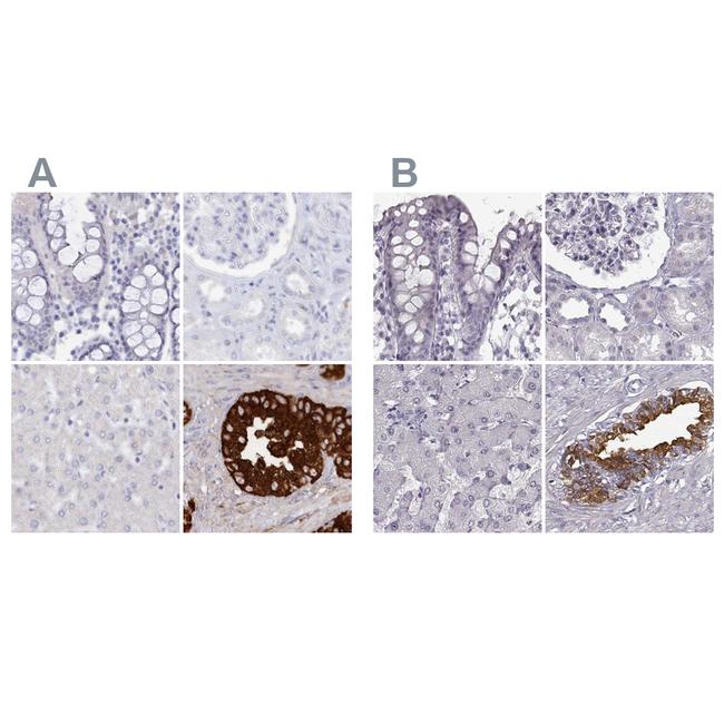 SEMG2 Antibody in Immunohistochemistry (IHC)