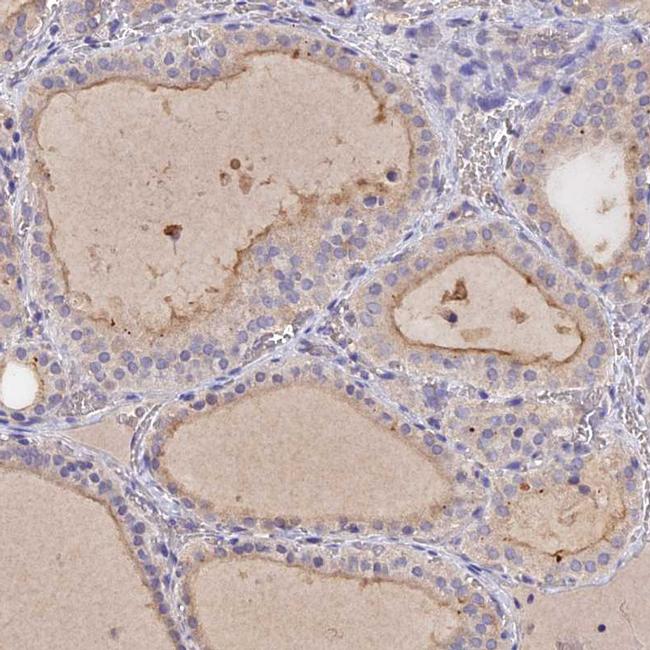 SLC26A4 Antibody in Immunohistochemistry (IHC)