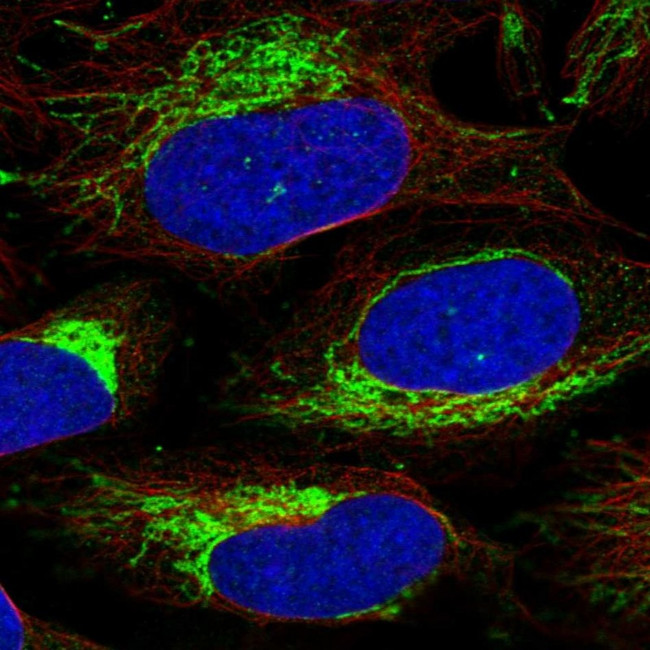 CHCHD3 Antibody in Immunocytochemistry (ICC/IF)