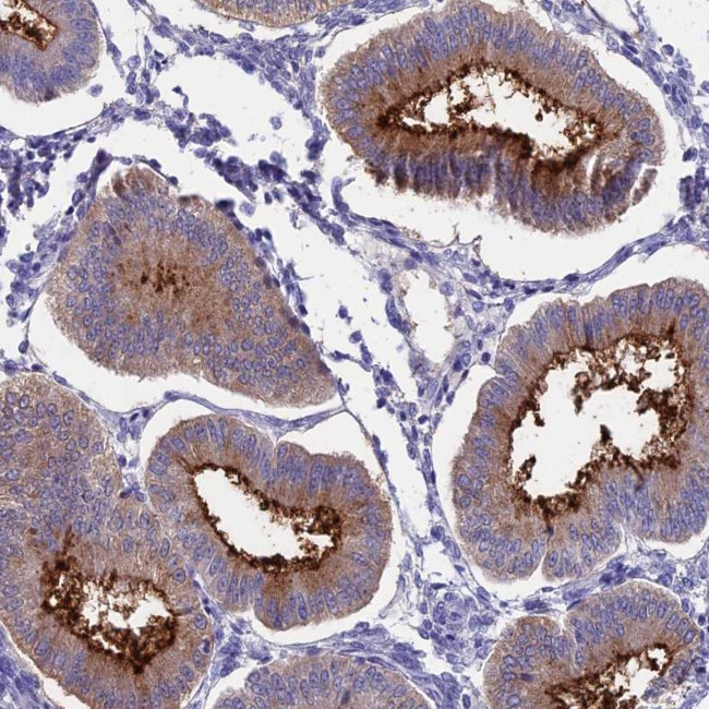 OR2AE1 Antibody in Immunohistochemistry (Paraffin) (IHC (P))