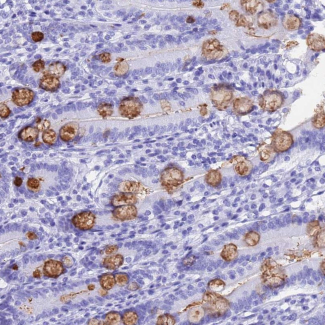 OR10J3 Antibody in Immunohistochemistry (Paraffin) (IHC (P))