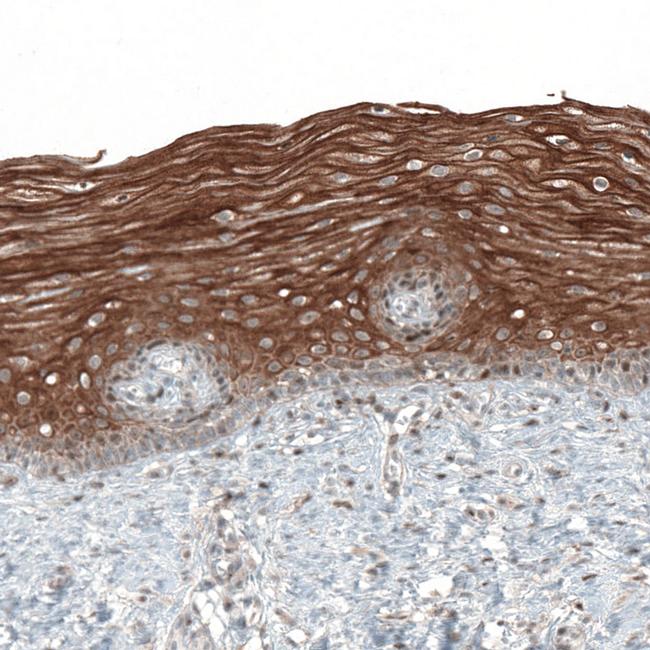 PAPD5 Antibody in Immunohistochemistry (IHC)