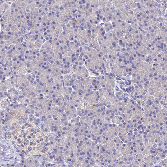 SPNS1 Antibody in Immunohistochemistry (Paraffin) (IHC (P))