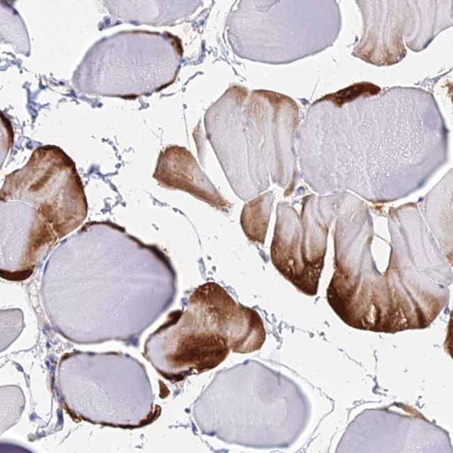 B3GALT4 Antibody in Immunohistochemistry (Paraffin) (IHC (P))