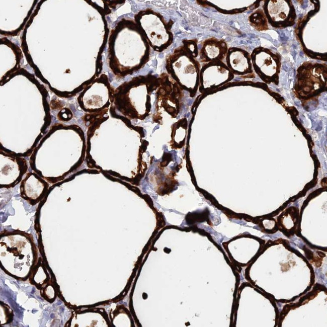 WDR46 Antibody in Immunohistochemistry (Paraffin) (IHC (P))