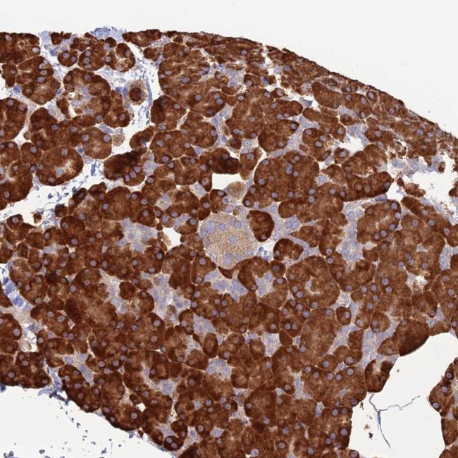 TRAPPC6A Antibody in Immunohistochemistry (Paraffin) (IHC (P))