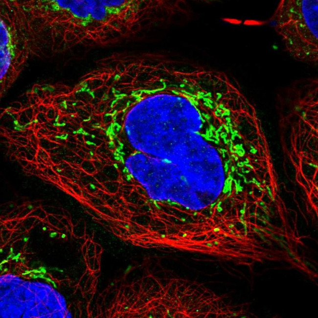 TIMM44 Antibody in Immunocytochemistry (ICC/IF)