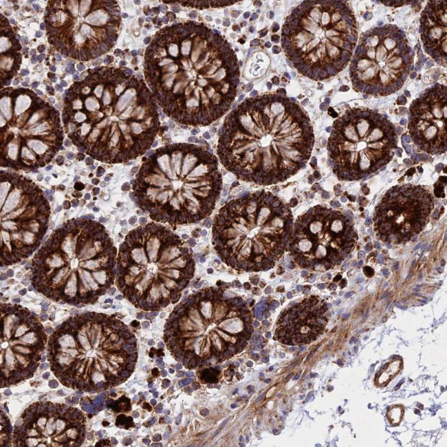 UQCRB Antibody in Immunohistochemistry (Paraffin) (IHC (P))