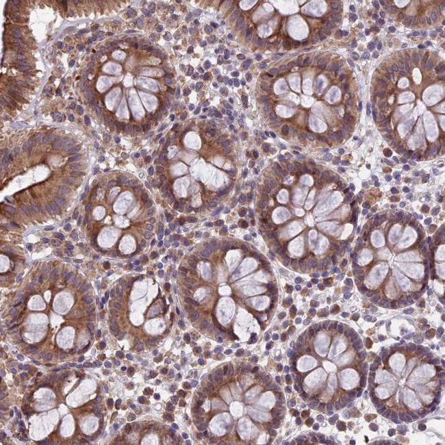 DMRTA2 Antibody in Immunohistochemistry (Paraffin) (IHC (P))