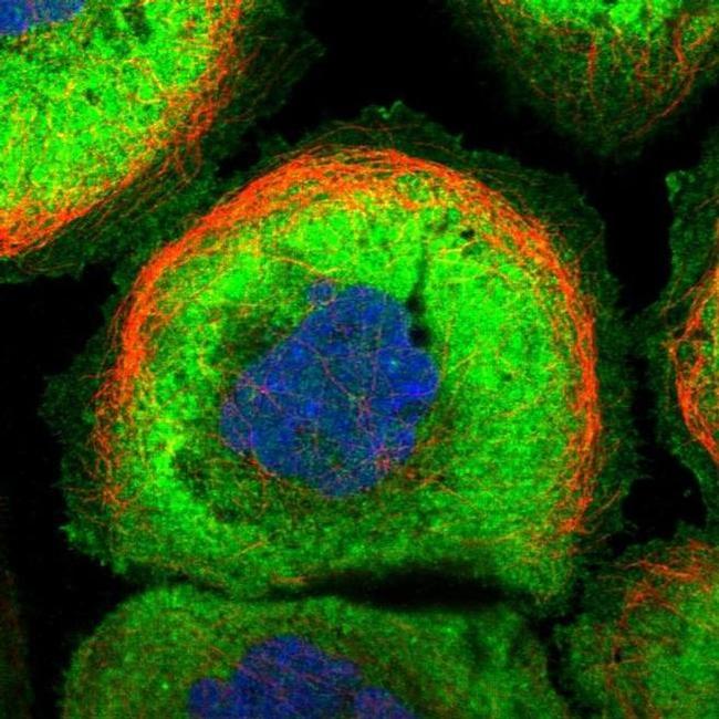 MFSD2A Antibody in Immunocytochemistry (ICC/IF)