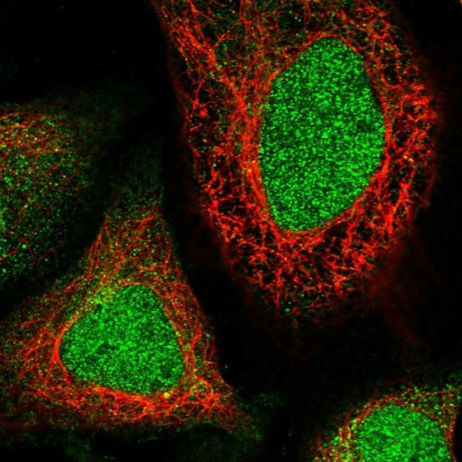 WDR41 Antibody in Immunocytochemistry (ICC/IF)