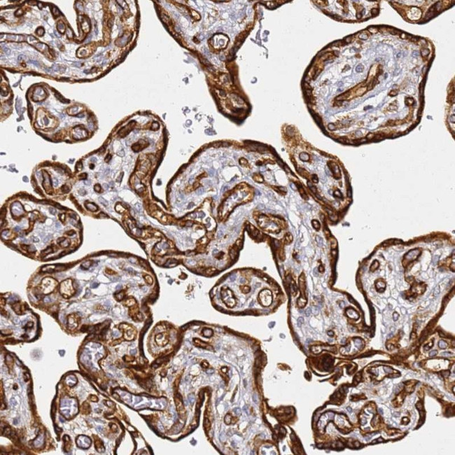 KIF7 Antibody in Immunohistochemistry (Paraffin) (IHC (P))