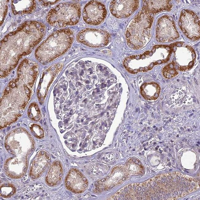 C14orf1 Antibody in Immunohistochemistry (IHC)