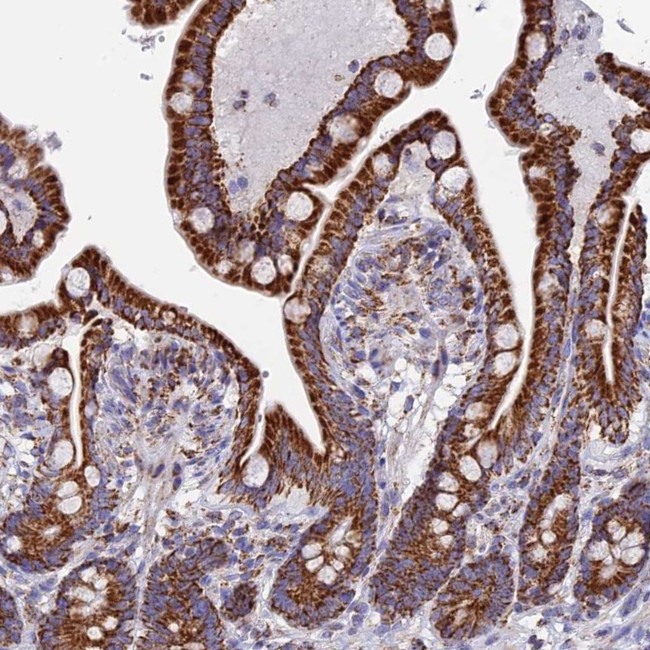 NDUFA5 Antibody in Immunohistochemistry (Paraffin) (IHC (P))